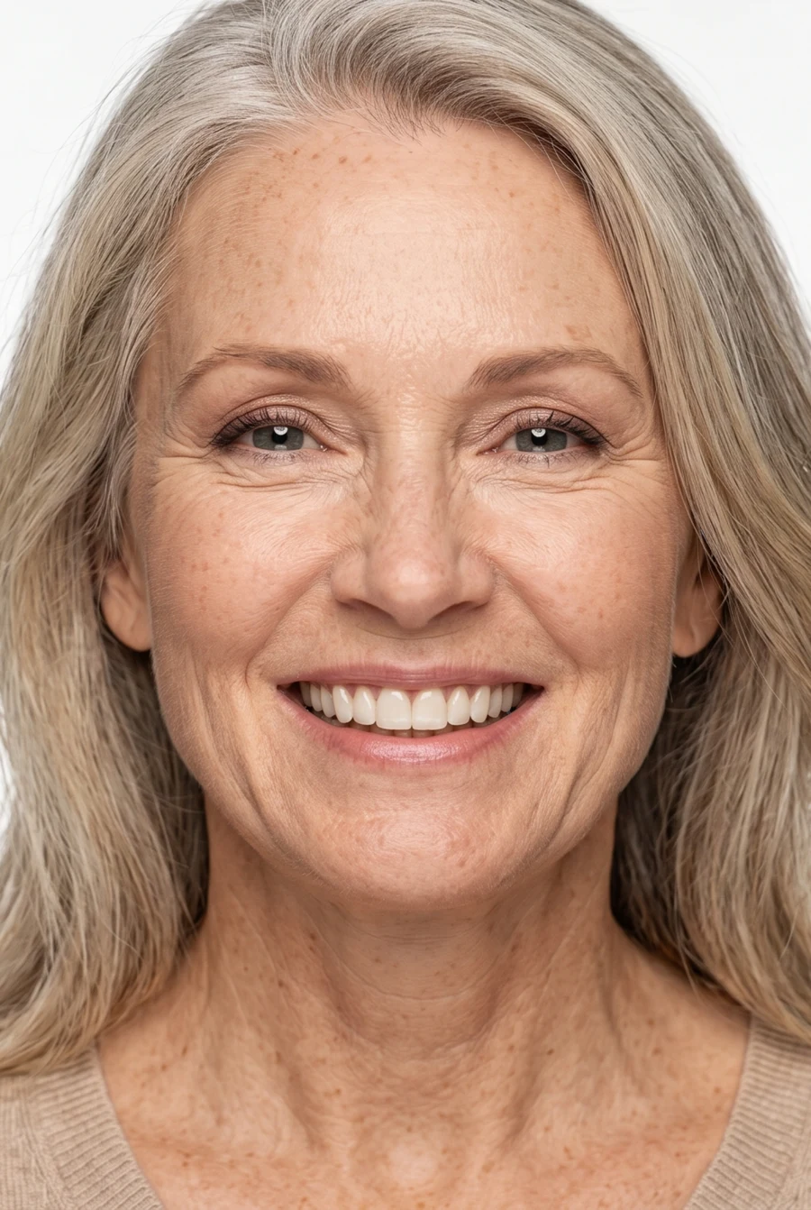Patient after veneers