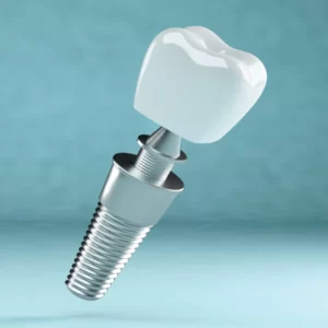 Tipos de protesis dentales y sus beneficios